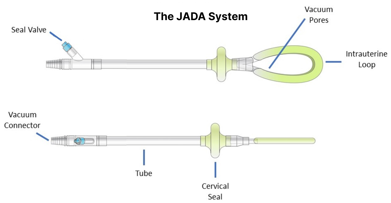 Diagram of the Key Areas of the JADA® System